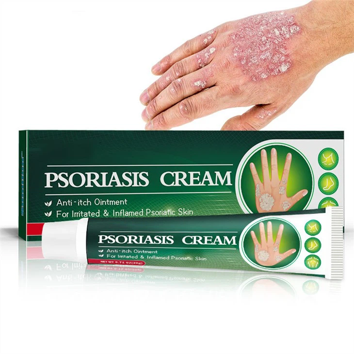 Infection fongique Psoriasis Crème Crème pour la Peau