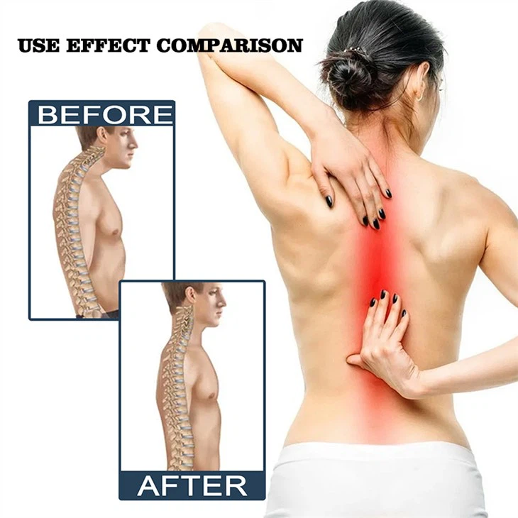 Lumbar Muscle Strain Skin Cream